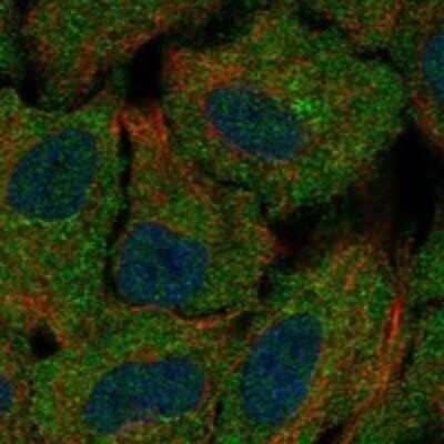 Immunocytochemistry/ Immunofluorescence: ChGn Antibody [NBP3-17694]