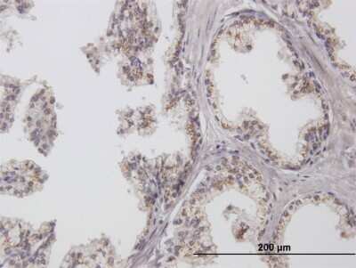 Immunohistochemistry-Paraffin: ChGn Antibody [H00055790-B02P]