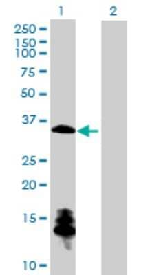 Western Blot: ChGn Antibody [H00055790-B01P]