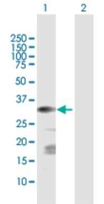 Western Blot: ChGn Antibody [H00055790-D01P]