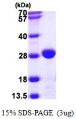 SDS-PAGE: Recombinant E. coli Chaperone protein FimC His Protein [NBP2-22648]