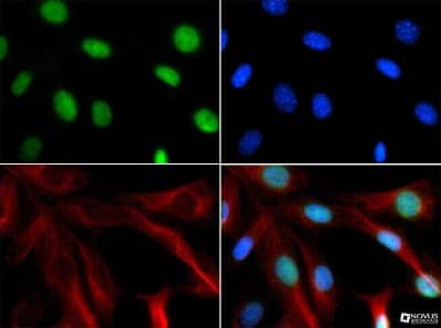 Immunocytochemistry/ Immunofluorescence: CHD7 Antibody - BSA Free [NBP1-77393]