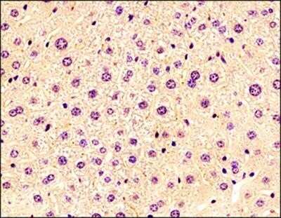 Immunohistochemistry-Paraffin: ChemR23/CMKLR1 Antibody (BZ194) - Azide and BSA Free [NBP2-80667]