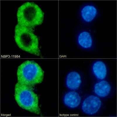 Immunocytochemistry/ Immunofluorescence: ChemR23/CMKLR1 Antibody (BZ194) - Chimeric - Azide and BSA Free [NBP3-11984]