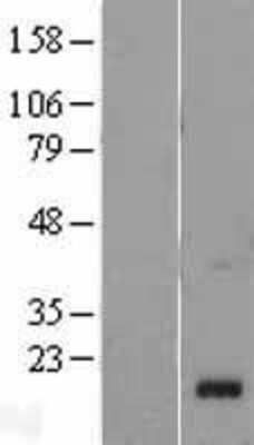 Western Blot: Chemerin Overexpression Lysate [NBL1-15160]