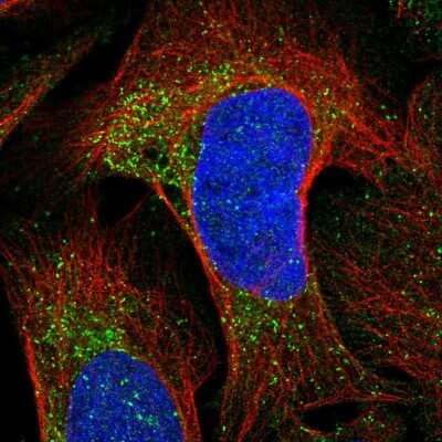 Immunocytochemistry/ Immunofluorescence: Chemokine-like factor Antibody [NBP2-56745]