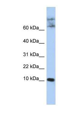 Western Blot: Chemokine-like factor Antibody [NBP1-59506]