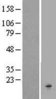 Western Blot: Chemokine-like factor Overexpression Lysate [NBL1-09219]