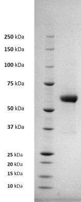 SDS-PAGE: Recombinant Virus Chikungunya Virus E1 His (C-Term) Protein [NBP3-14807]