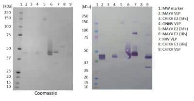 Western Blot: Chikungunya Virus VLP Antibody (AG7-2-A7-E10) [NBP3-14852]
