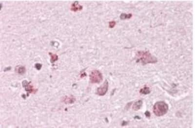 Immunohistochemistry-Paraffin: Chimaerin 2 Antibody [NBP1-36945]