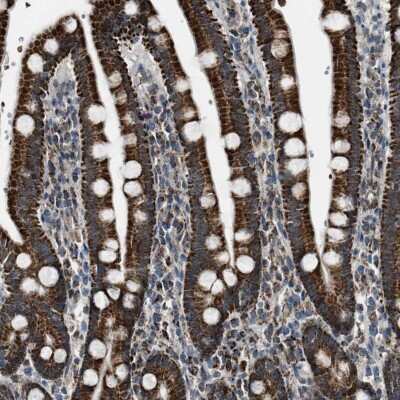 Immunohistochemistry-Paraffin: Chimaerin 2 Antibody [NBP1-90108]