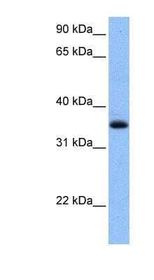 Western Blot: Chimaerin 2 Antibody [NBP1-55094]