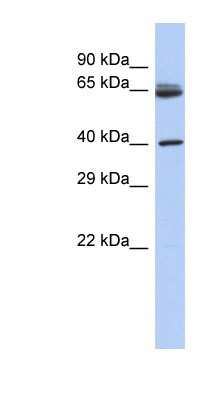 Western Blot: Chimaerin 2 Antibody [NBP1-55257]