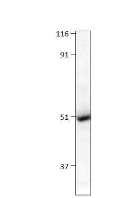 Western Blot: Chimaerin 2 Antibody [NBP3-12294]