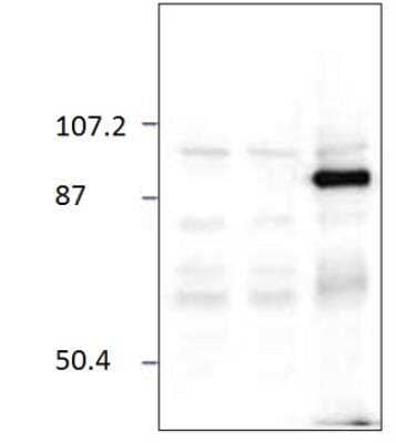 Western Blot: Chimaerin 2 Antibody [NBP3-12460]