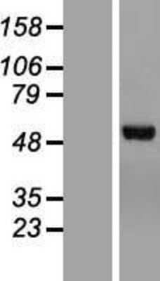 Western Blot: Chimaerin 2 Overexpression Lysate [NBL1-09166]