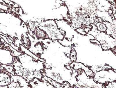 Immunohistochemistry-Paraffin: Chitinase 3-like 2 Antibody (213) [NBP2-90064]