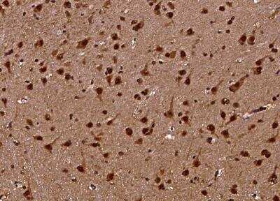 Immunohistochemistry-Paraffin: Chitinase 3-like 2 Antibody (213) [NBP2-90064]