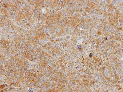 Immunohistochemistry-Paraffin: Chitinase 3-like 2 Antibody [NBP1-33193]