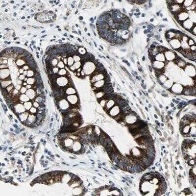 Immunohistochemistry-Paraffin: Chitinase 3-like 2 Antibody [NBP1-86845]