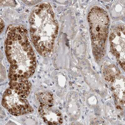 Immunohistochemistry-Paraffin: Chitobiase/CTBS Antibody [NBP1-85388]