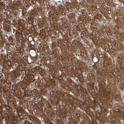 Immunohistochemistry-Paraffin: Chitobiase/CTBS Antibody [NBP1-85388]