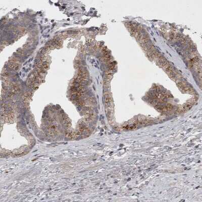 Immunohistochemistry-Paraffin: Chitobiase/CTBS Antibody [NBP1-85388]