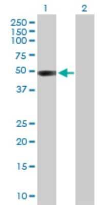 Western Blot: Chitobiase/CTBS Antibody [H00001486-D01P]