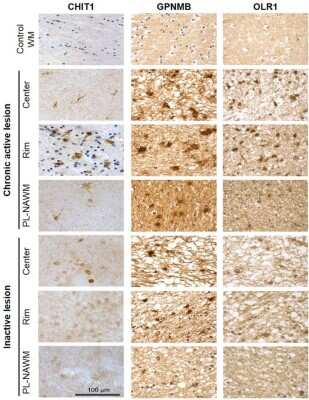 Immunohistochemistry-Paraffin: Chitotriosidase/CHIT1 Antibody [NBP1-84490]