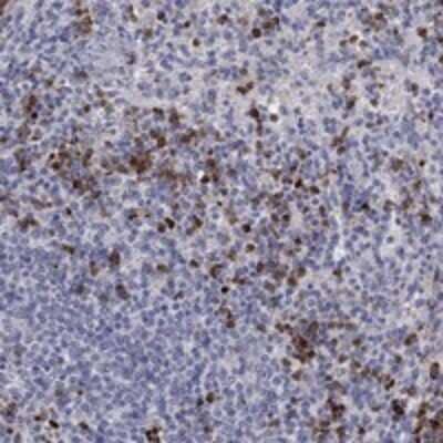 Immunohistochemistry-Paraffin: Chitotriosidase/CHIT1 Antibody [NBP3-17651]