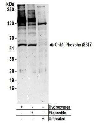 Western Blot: Chk1 [p Ser317] Antibody [NBP2-37703]