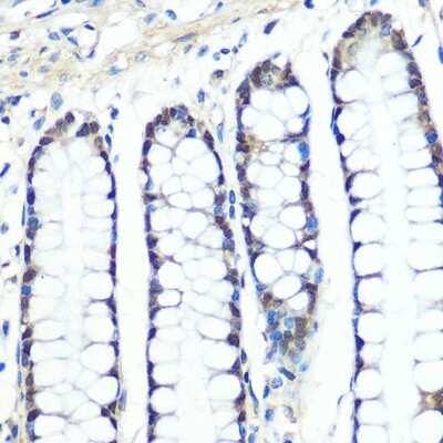 Immunohistochemistry-Paraffin: Chk1 Antibody (0S3Q1) [NBP3-16353]