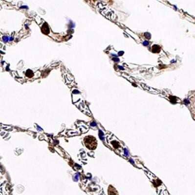 Immunohistochemistry-Paraffin: Chk1 Antibody (2G1D5) - Azide and BSA Free [NBP2-80668]