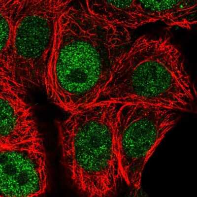 Immunocytochemistry/ Immunofluorescence: Chk1 Antibody [NBP2-58441]