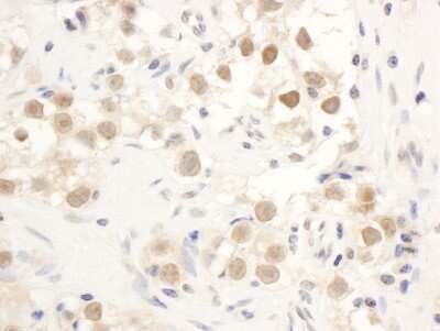 Immunohistochemistry-Paraffin: Chk1 Antibody [NB100-464]
