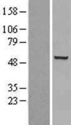 Western Blot: Chk1 Overexpression Lysate [NBL1-09146]