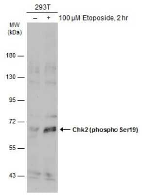 Western Blot: Chk2 [p Ser19] Antibody [NBP3-13328]