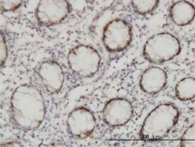 Immunohistochemistry-Paraffin: Chk2 Antibody (4B7) [H00011200-M01]