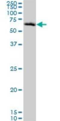 Western Blot: Chk2 Antibody (4B7) [H00011200-M01]