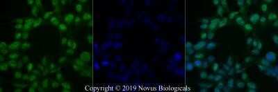 Immunocytochemistry/ Immunofluorescence: Chk2 Antibody (73C175.1.1) - Azide Free [NBP2-27403]