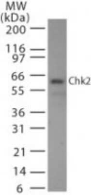 Western Blot: Chk2 Antibody (73C175.1.1)Azide Free [NBP2-27403]