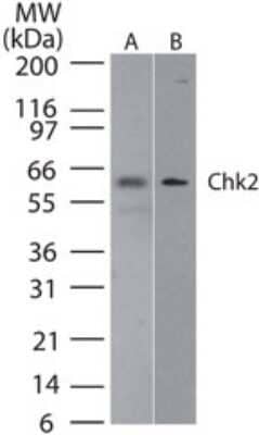 Western Blot: Chk2 Antibody (73C175.1.1)Azide Free [NBP2-27403]