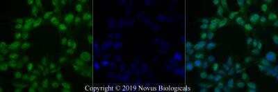 Immunocytochemistry/ Immunofluorescence: Chk2 Antibody (73C175.1.1) [NB100-56546]