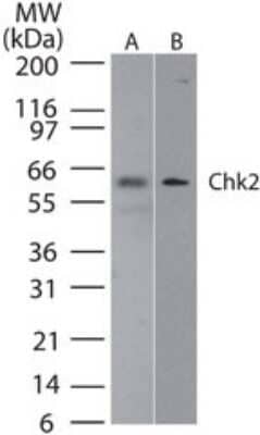 Western Blot: Chk2 Antibody (73C175.1.1) [NB100-56546]