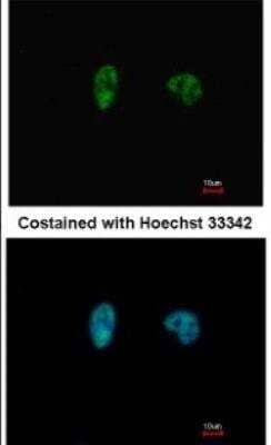 Immunocytochemistry/ Immunofluorescence: Chk2 Antibody (8F12) [NB100-500]