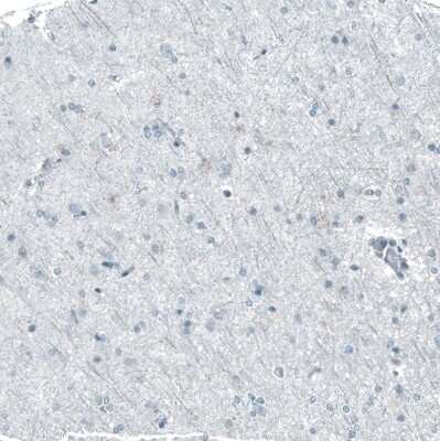 Immunohistochemistry-Paraffin: Chk2 Antibody (CL9440) [NBP2-88933]