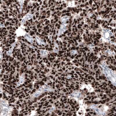 Immunohistochemistry-Paraffin: Chk2 Antibody (CL9440) [NBP2-88933]
