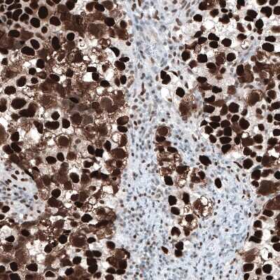 Immunohistochemistry-Paraffin: Chk2 Antibody (CL9440) [NBP2-88933]