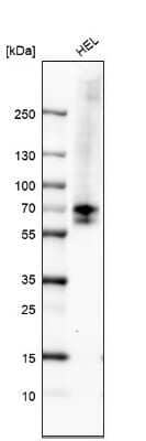 Western Blot: Chk2 Antibody (CL9440) [NBP2-88933]